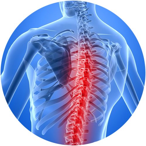 Illustration of a spine in pain